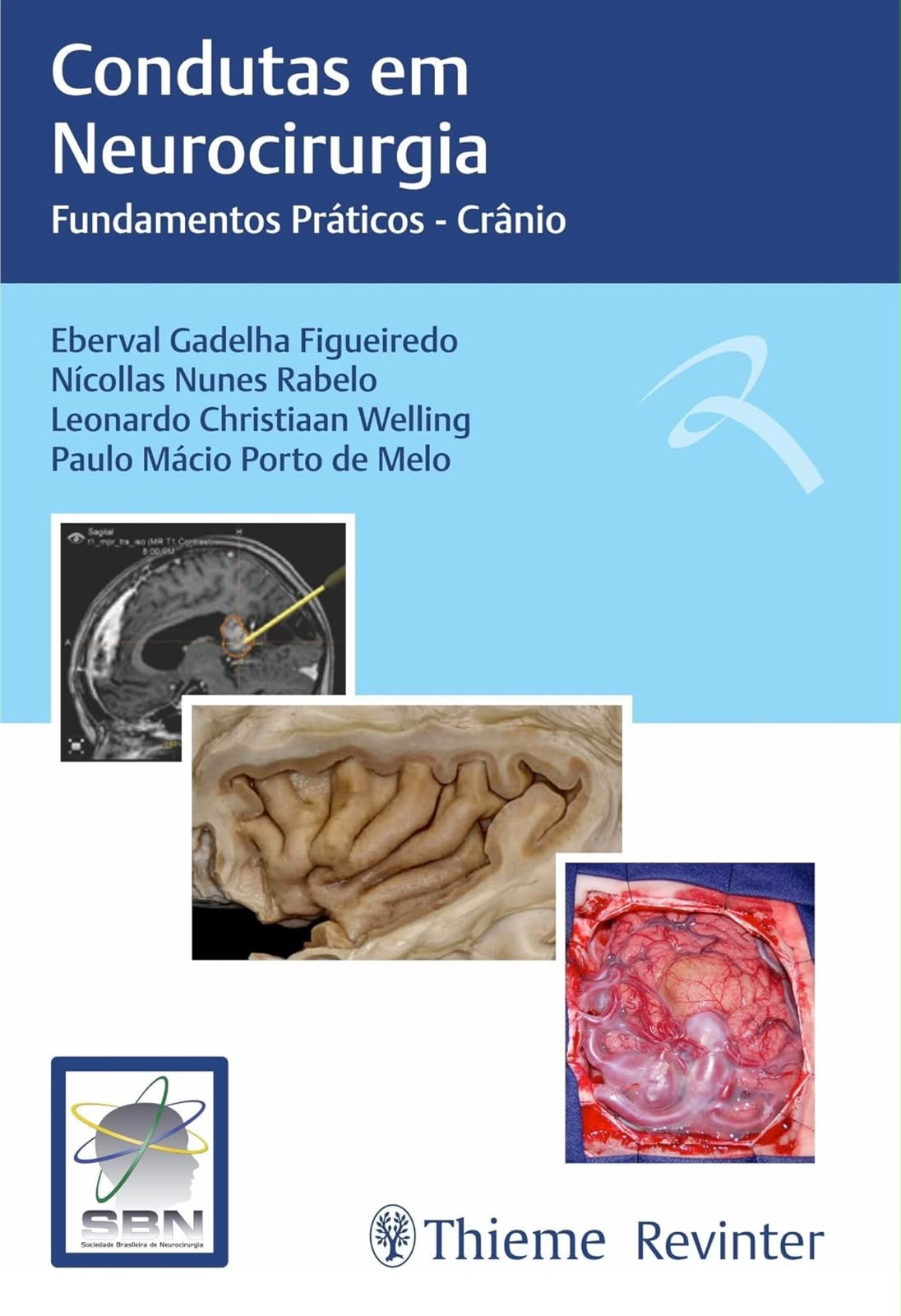 Livro Condutas em Neurocirurgia, Crânio